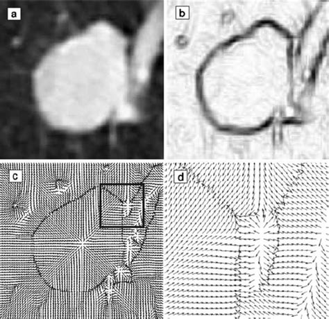 Image result for Gradient Vector Flow Python