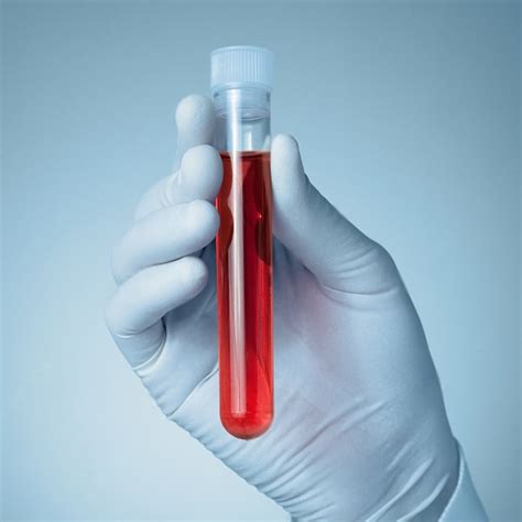 Full Body Checkup and C-Peptide - Blood Test – Muditam Ayurveda