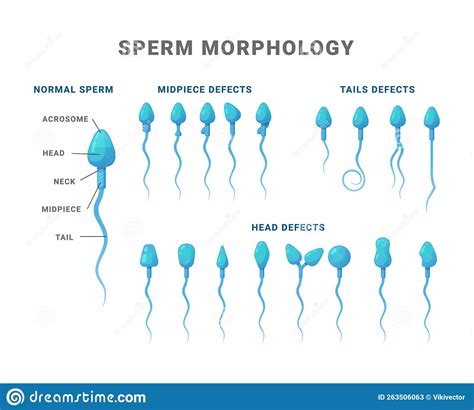 Sperm Morphology Count Type Educational Medical Scheme Vector Flat ...