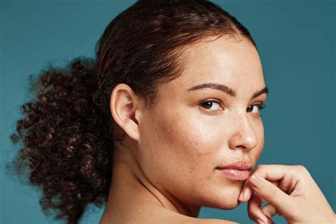 Image result for Sebum Plug Extraction