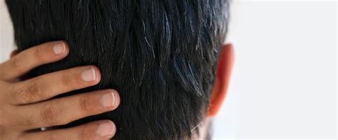 Air Pollution & Hair Loss: Effects & Solutions