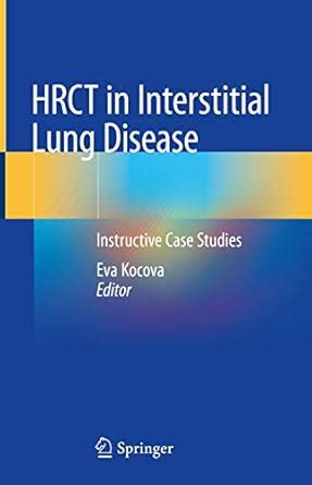 HRCT in Interstitial Lung Disease: Instructive Case Studies eBook ...
