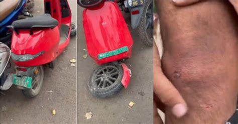Front suspension of another Ola S1 electric scooter breaks: rider injured