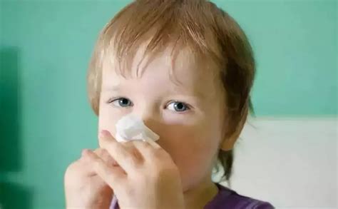 婴儿流鼻血是什么原因引起的（孩子经常流鼻血是因为患上白血病）-幼儿百科-魔术铺