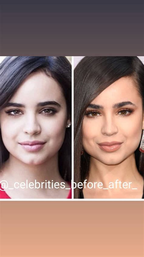 Sofia Carson's Plastic surgeries | Sofia carson, Plastic surgery, Sofia