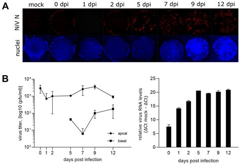 Analysis of Nipah Virus Replication and Host Proteome Response Patterns ...