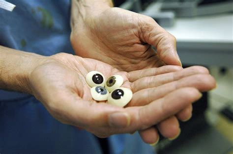 What To Expect With Eye Removal Surgery (Enucleation) - Eyes Advisor