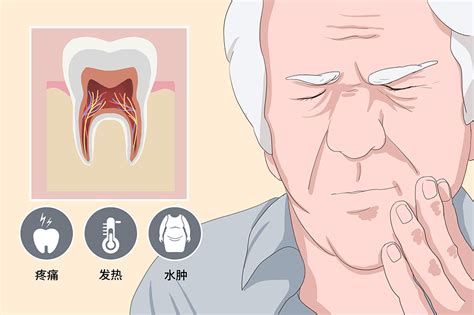 牙髓炎晚期不治什么后果？应该怎么确定是不是牙髓炎？该怎么治疗_皓齿口腔网