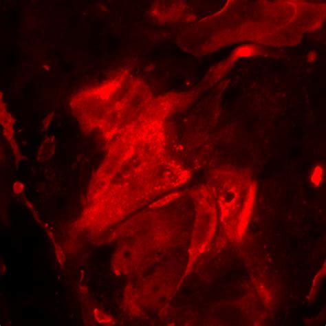 Involucrin antibody (55328-1-AP) | Proteintech