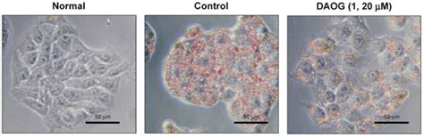 A Gedunin-Type Limonoid, 7-Deacetoxy-7-Oxogedunin, from Andiroba ...