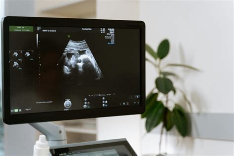 Sonogram vs Ultrasound - What's the Difference? - AHWC