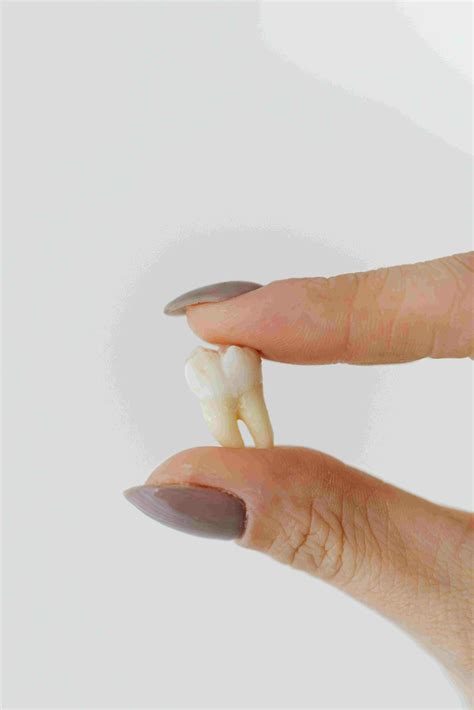 Does Everyone Have Wisdom Teeth? Let us explain