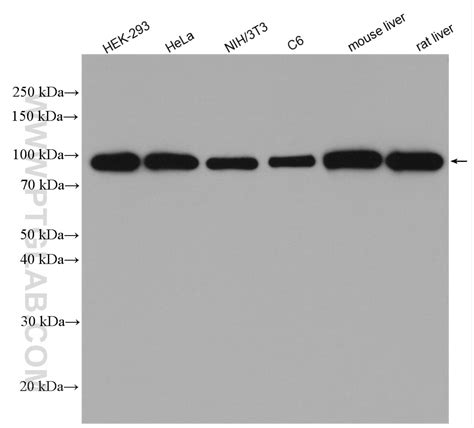 Beta Catenin antibody (17565-1-AP) | Proteintech