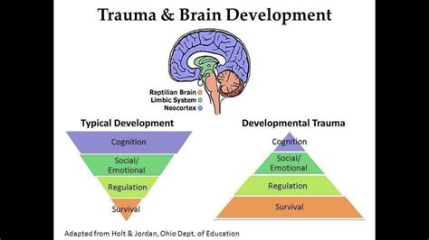 Image result for Trauma Brain Development