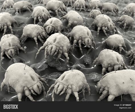 Dust Mite Electron Microscope
