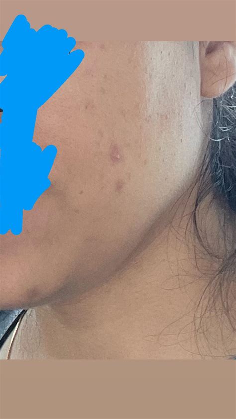My skin looks ugly and feels bumpy : r/CanSkincare