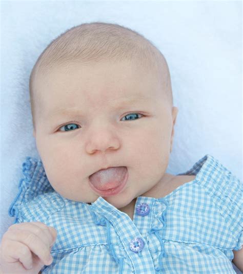 How To Cure Baby Thrush - Soupcrazy1