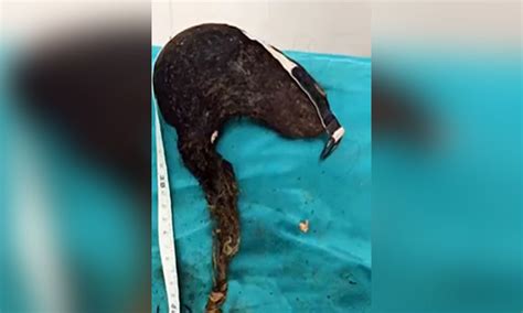 14 ఏళ్ల బాలిక కడుపులో.. అమ్మో..! | Jaipur doctors remove world's ...