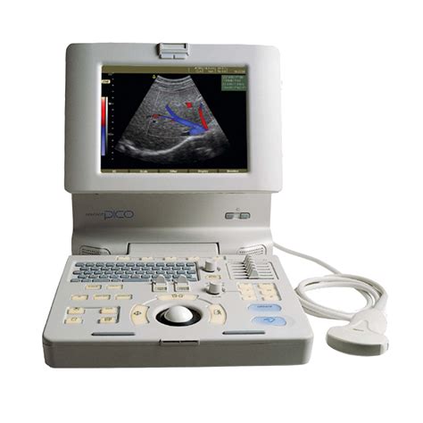 Medison's SonoAce Pico Portable Handheld Ultrasound Machine