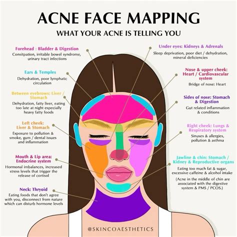 Pin by Hannah on skincare | Face mapping acne, Face acne, Skin care routine