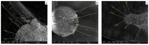 Scanning Electron Microscopy Analysis of the Intratubular Radicular ...