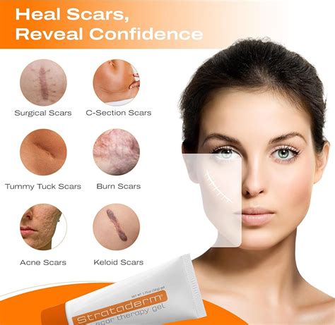 Strataderm Professional Scar Therapy Gel | Old and India | Ubuy