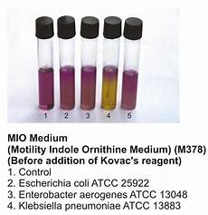 dispense microbiologia motility tests for bacteria principles procedures and dispense microbiologia motility tests for bacteria principles procedures and