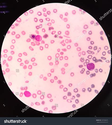 Nrbc On Blood Smear Stock Photo (Edit Now) 767934673