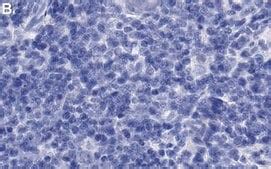 Anti-CXCL10 Antibody, clone 3F14 ZooMAb® Rabbit Monoclonal recombinant ...