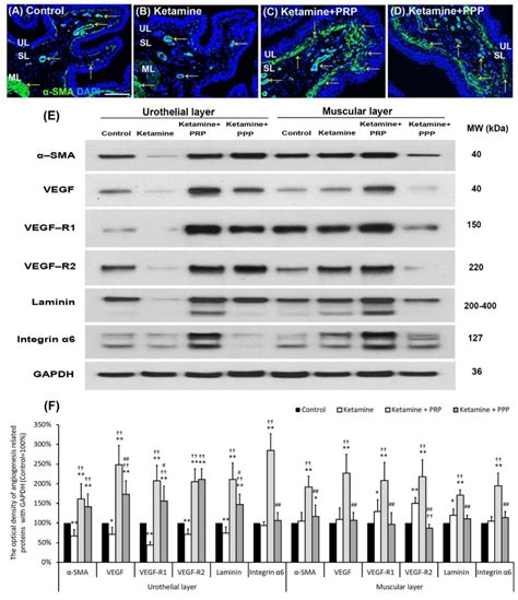 Therapeutic Effect of Platelet-Rich Plasma Improves Bladder ...