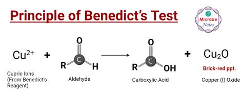 Image result for Benedict Test