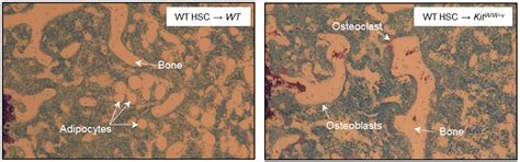 Bone Marrow Adipose Tissue Is Not Required for Reconstitution of the ...