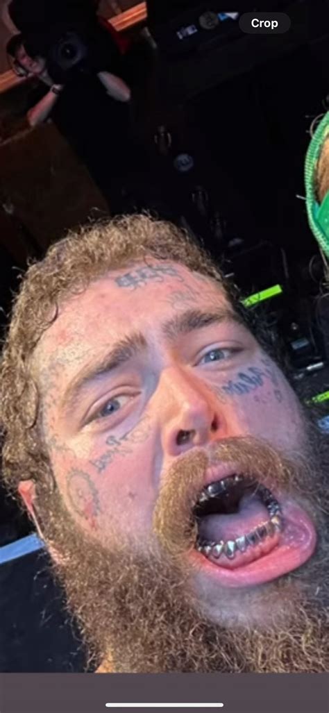 what’s happened to his teeth? : r/PostMalone
