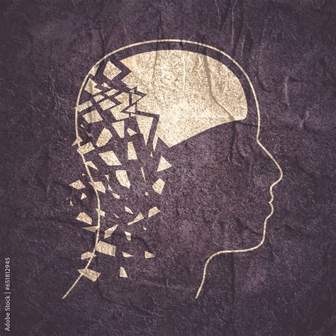 Image result for Brain Decimation