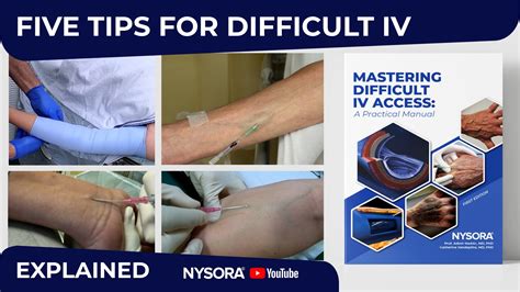 IV tips that make a difference - NYSORA