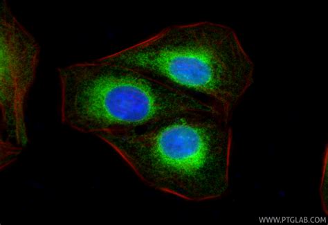 Calnexin antibody (10427-2-AP) | Proteintech