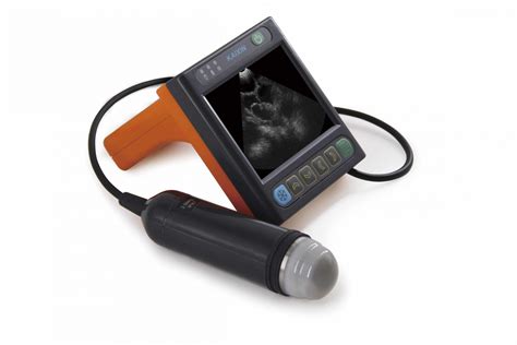 Portable Ultrasound Machine
