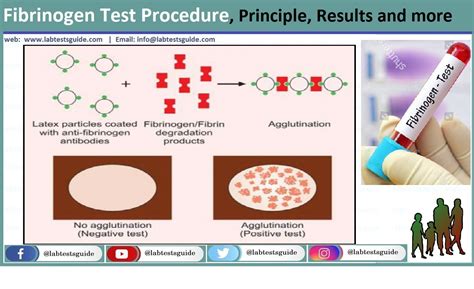 Image result for Fibrinogen Test Procedure