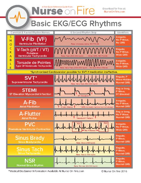 Vf Ecg Multiple