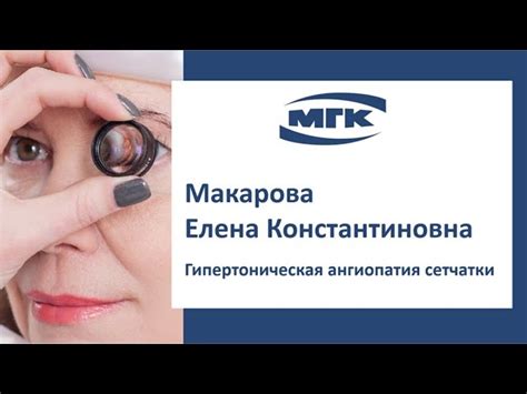 Ангиопатия сетчатки обоих глаз (сосудов): симптомы и лечение по коду ...