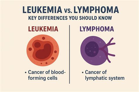 Leukemia vs. Lymphoma: Key Differences You Should Know