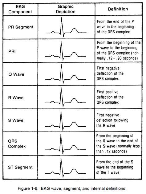 Ecg Sine Wave Pattern