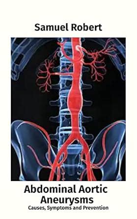 Abdominal Aortic Aneurysm: Causes, Symptoms and Prevention eBook ...