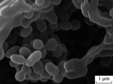 Image result for Enterococcus Chlorination