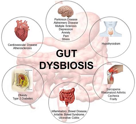 Gut Dysbiosis and Metabolism: How Gut Microbiome Imbalance Causes ...