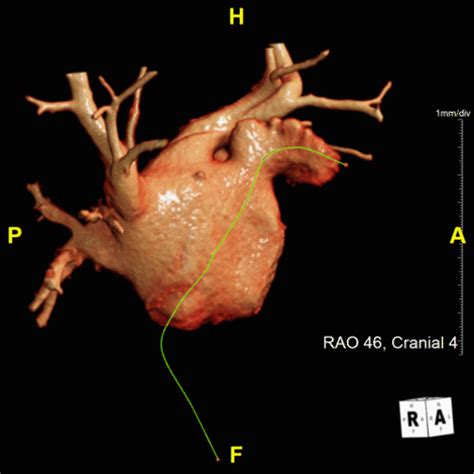 Image result for Video Watchman Device.com