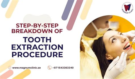 Image result for Basic Tooth Extraction
