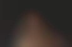 Image result for Dissolving Thread Bathing Suit