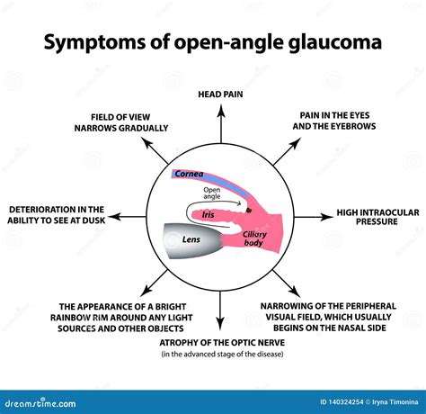 Glaucoma Information
