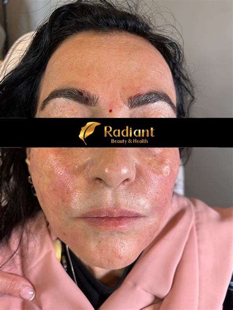 Image result for Face Threads